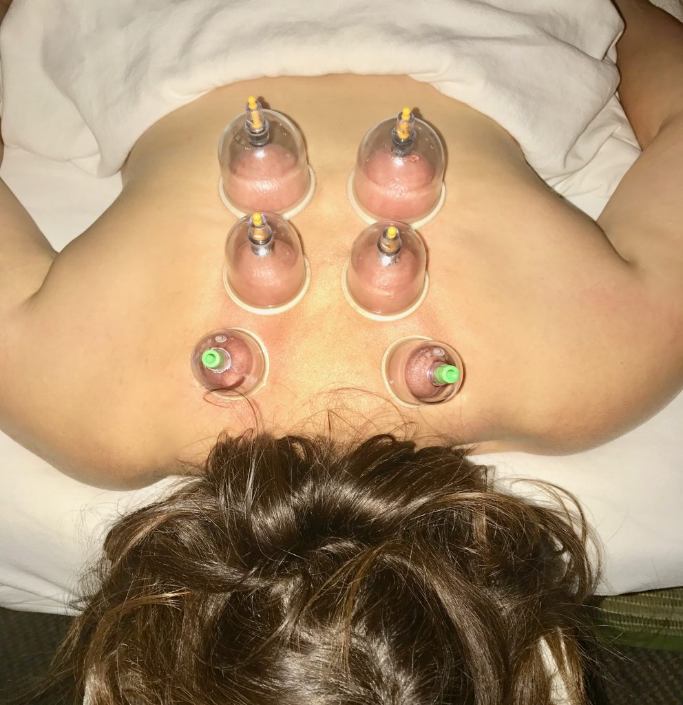 cupping treatment at a spa